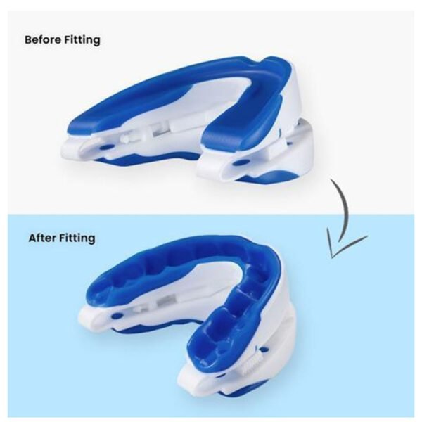 描述图_06 Sleep Aid Anti-Snoring Mouth Guard – Adjustable Snore Stopper & Bruxism Relief