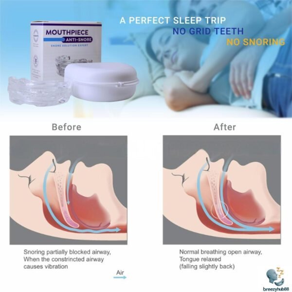 4_O1CN01qtqAF41UCLUCMk Adjustable Anti-Snoring Mouthguard – Custom Fit Sleep Aid